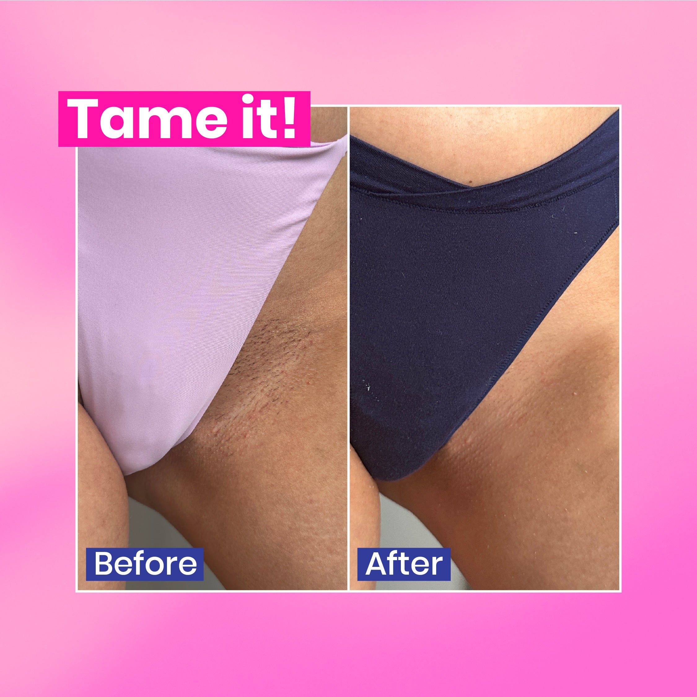 Tame it! Hair Removal Cream Dolphin Smooth Bundle